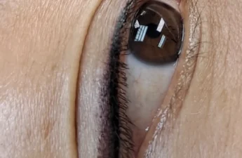 cosmetic tattoo eyeliner