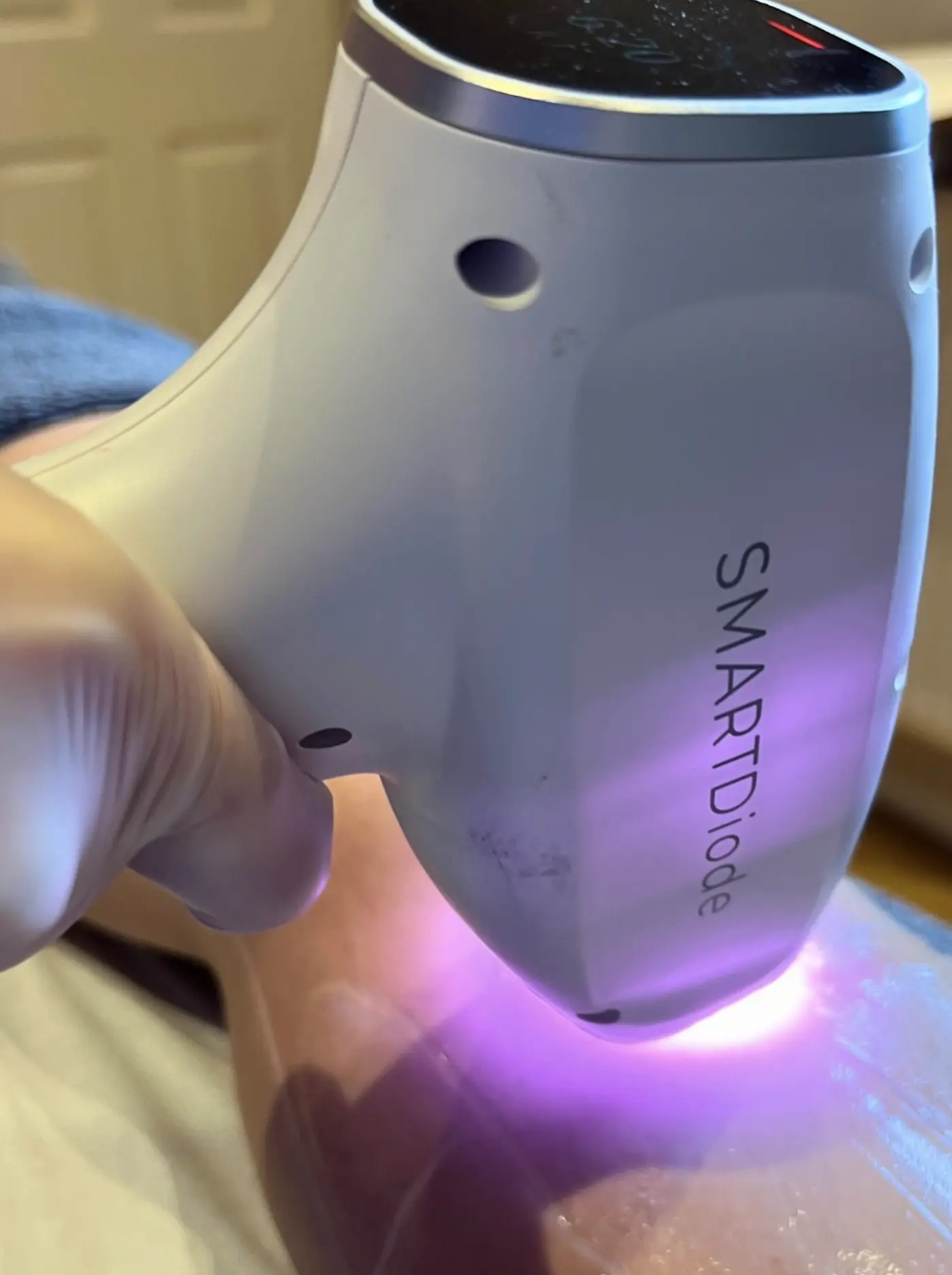 ipl laser hair removal course