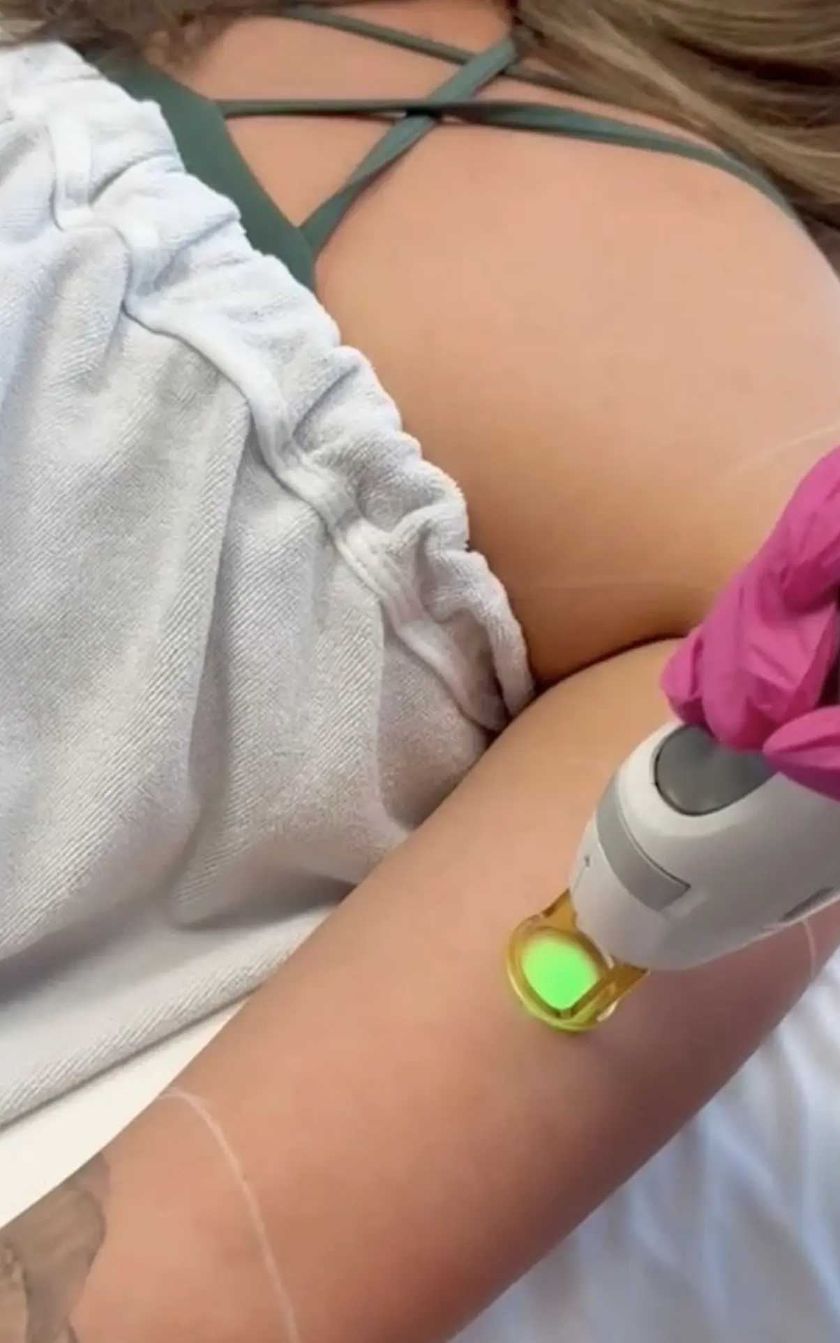 laser hair removal at home course